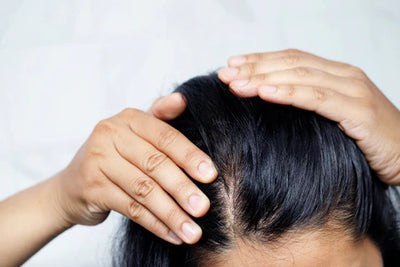 Hair Loss Guide : Hair Loss In Women & Solutions